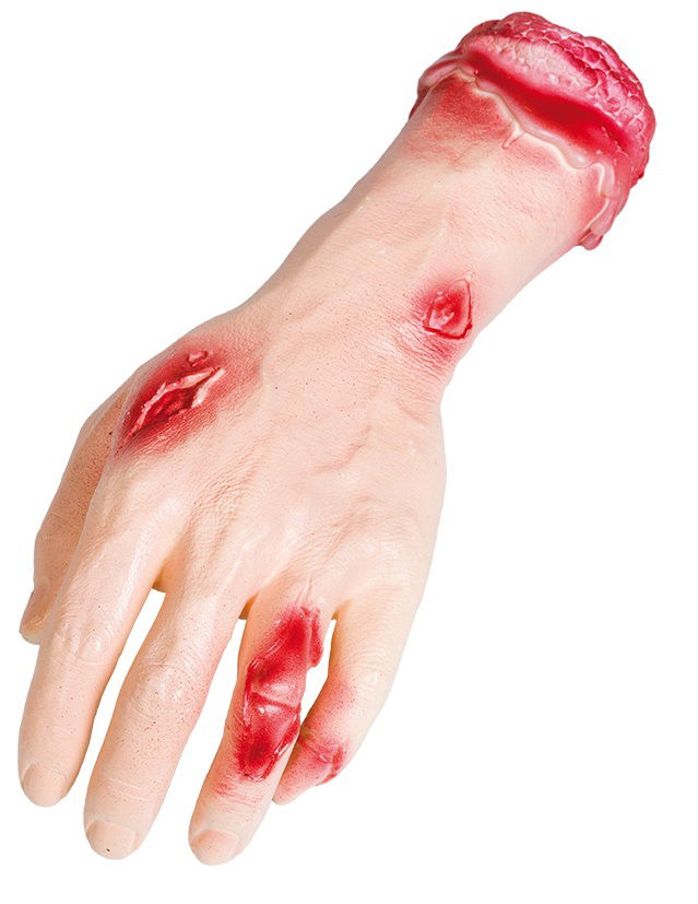 Avhuggen Hand